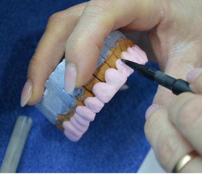 Creadent Clinic's in-house CAD/CAM laboratory, Tirana — follow the clinic on Instagram