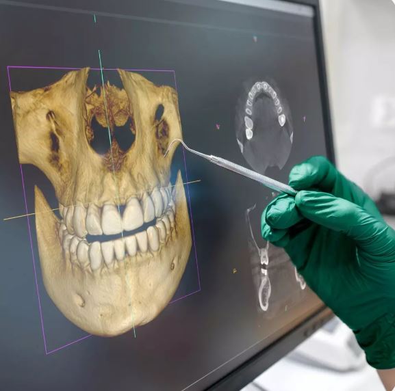 Digital intraoral scanner and 3D diagnostics at the Gaia dental clinic in Tirana, Albania
