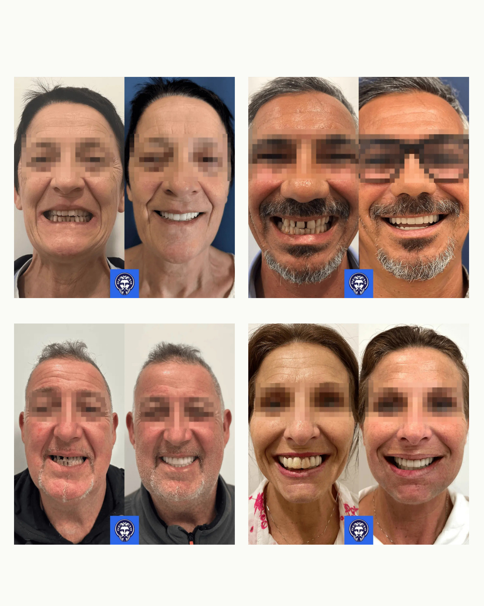 Esperti dental implants